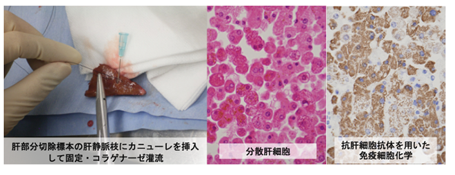 図2　手術検体からの肝細胞の純化